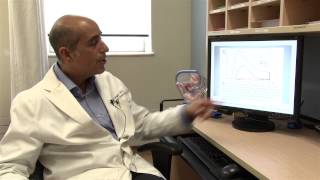 Colposcopy Educational Video with Dr Ziegler [upl. by Akkire]