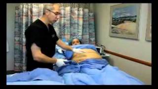 Liposuction VASER Lipo PAL Liposuction [upl. by Mirilla771]