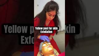 Yellow peel for akin exfoliation at Delhi  8287001211  peels peeloff skincareroutine [upl. by Igenia335]