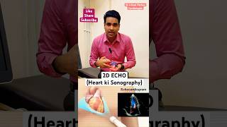 2D ECHO Cardiography ultrasound of Heart heartdoctor cardiovasculardisease echocardiography [upl. by Kriss754]