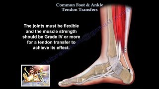 Common Foot amp Ankle Tendon Transfers  Everything You Need To Know  Dr Nabil Ebraheim [upl. by Ardnoek]