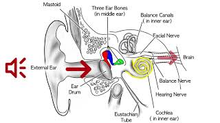 Sensorineural Hearing Loss [upl. by Oicirbaf]