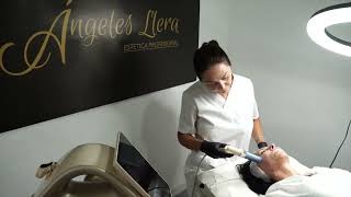 HIFU 12 MPT FACIAL en Sevilla [upl. by Lleksah973]