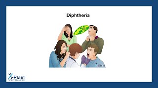 Diphtheria [upl. by Kamp]