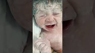 Baby have lots of vernix viralvideo newbornbaby littleprince littleheart [upl. by Nawuj945]