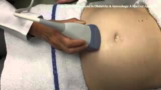 Ultrasound in Obstetrics amp Gynecology A Practical Approach  Clip 102 [upl. by Selda]