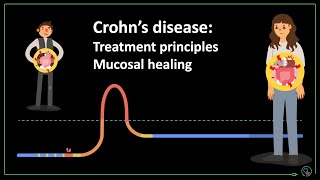 Crohns disease treatment principles and mucosal healing [upl. by Lamag]