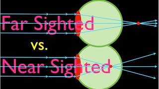 Farsighteness vs Nearsightedness An Explanation [upl. by Aynatan114]