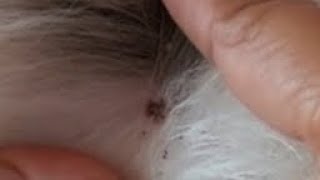 NAGPAKUHA SIYA UG GARAPATA SA IYANG TIILREMOVING TICKS [upl. by Mirabella394]