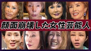 【衝撃画像】顔面崩壊した女性芸能人・有名人25選【※多重整形・整形失敗・事故】 [upl. by Goldman407]