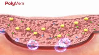 How PolyMem Wound Dressing Works [upl. by Acinnej]