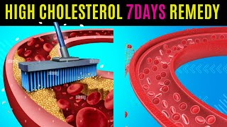 The Most Effective Way to Lower Your Cholesterol Naturally in 7 Days [upl. by Warila]