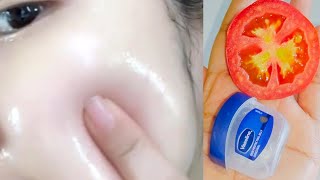 Apply vaseline and tomato on your skin and see the magic  Vaseline on face  Vasline beauty hacks [upl. by Eikcim]