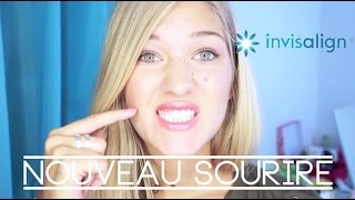 Un nouveau sourire avec Invisalign [upl. by Llehsyar]