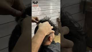 Hair Clip Method  Hair patch For men [upl. by Barbuto575]