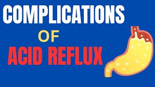 COMPLICATIONS OF ACID REFLUXGERD [upl. by Xever]