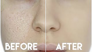 HOW TO HIDE ENLARGED PORES amp MAKE YOUR PORES DISAPPEAR [upl. by Annayoj]