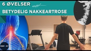 6 Øvelser mot Betydelig Nakkeartrose [upl. by Kenyon]