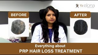 What is PRP Treatmentplatelet rich Plasma PRP therapy for hair problems  Before amp After Results [upl. by Nnyliak496]