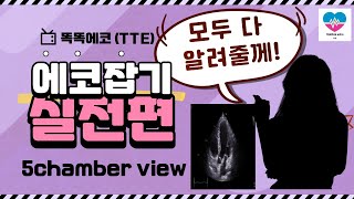 심장초음파실전 Apical 5chamber view 잡기 echocardiography 심장초음파 똑똑에코 TTE rdcs cardiology heart [upl. by Yralam343]