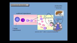 Anemia of increased red cell destruction loss [upl. by Erodaeht]