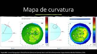 Topografía corneal [upl. by Roman]