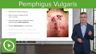 Pemphigus Vulgaris – Dermatology  Lecturio [upl. by Shum]