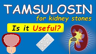 Tamsulosin for Kidney Stones  6 Things to Know [upl. by Hairim]