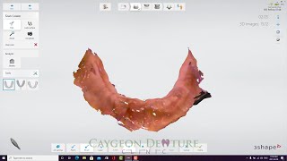 Scanning Workflow to Fabricate a Complete Lower Denture [upl. by Atikan]