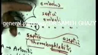 general pathology 7 toxaemia septicaemiapyaemiabacteraemia  repair1 by DR SAMEH GHAZY [upl. by Wrdna]