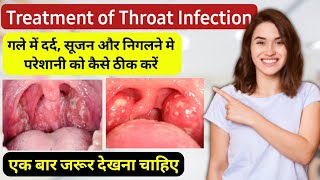 Pharyngitis throat infection treatment in hindi  गले में खराश दर्द और सूजन होने पर क्या करें [upl. by Jak459]