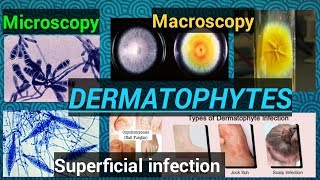 Fungal infectionFungal cultureFungal identificationDermatophytesDermatophytosisSTAR LABORATORY [upl. by Franklyn]