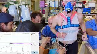 Cardiac Output measurement using thermodilution [upl. by Arev]