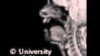 MRI uvular fricative [upl. by Etty771]