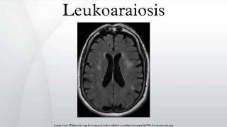 Leukoaraiosis [upl. by Adiarf]