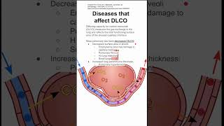 Diseases that affect DLCO [upl. by Einolem]