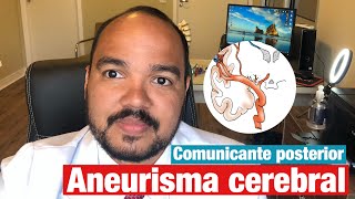 Aneurisma Cerebral  Artéria Comunicante Posterior Quais são os sintomas de quem tem aneurisma [upl. by Islek149]