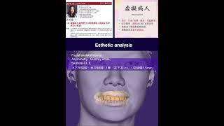 Virtual patient esthetic analysis [upl. by Elleiand]