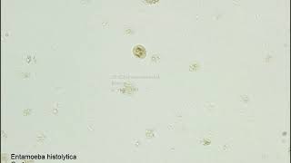 Entamoeba histolyticaCyst [upl. by Nur]