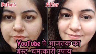 अनचाहे बालों से छुटकारा amp गोरी निखरी त्वचा  Whitening  Unwanted Hair Removal 2 in 1 Remedy [upl. by Dumas]