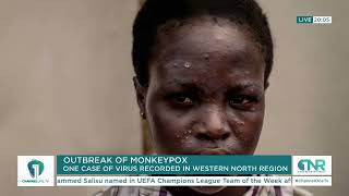 Outbreak of Monkeypox in Ghana First Case Recorded in Western North Region [upl. by Avra]