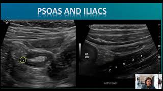 Optimizing The Appendix [upl. by Mchale]