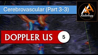 5  Cerebrovascular System Part 33 [upl. by Irollam]