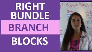 How to Interpret EKG Right Bundle Branch Blocks on ECG for Nurses [upl. by Berlyn]