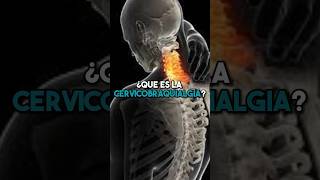 ➡️ ¿Qué es la cervicobraquialgia 🤔 fisioterapiatualcance [upl. by Latimer708]