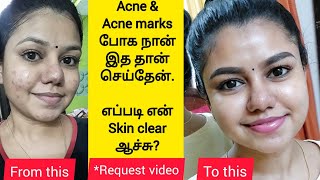 How I cleared my acne  My skincare routine for Acne amp Acne marks  Best products for pimple skin [upl. by Haleak849]