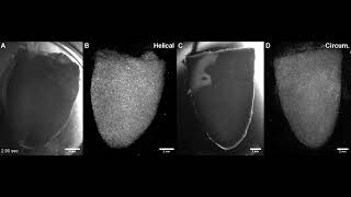 Supplemental Video 6  Ventricle Scaffolds with Human stemcell derived Cardiomyocytes [upl. by Adall]