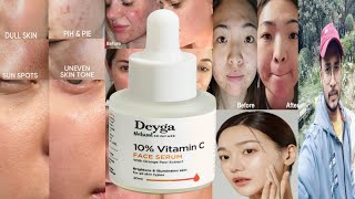 Deyga 10 Vitamin C Face Serum  Honest Review [upl. by Acisset83]