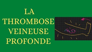 La thrombose veineuse profonde simplifiée [upl. by Woodall]