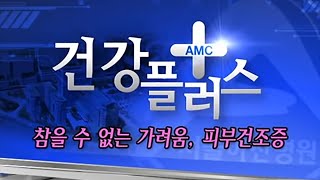 참을 수 없는 가려움  피부건조증 [upl. by Meelas]